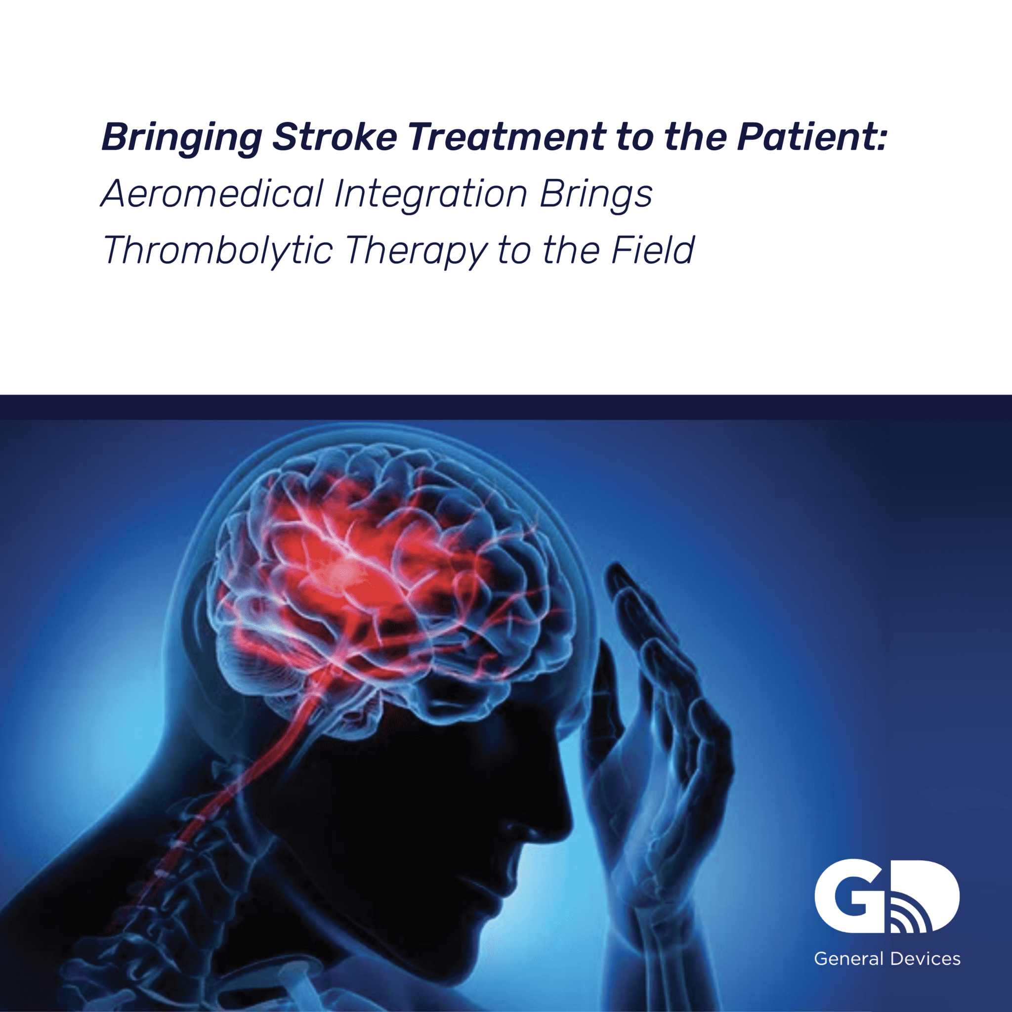 Bringing Stroke Treatment to the Patient